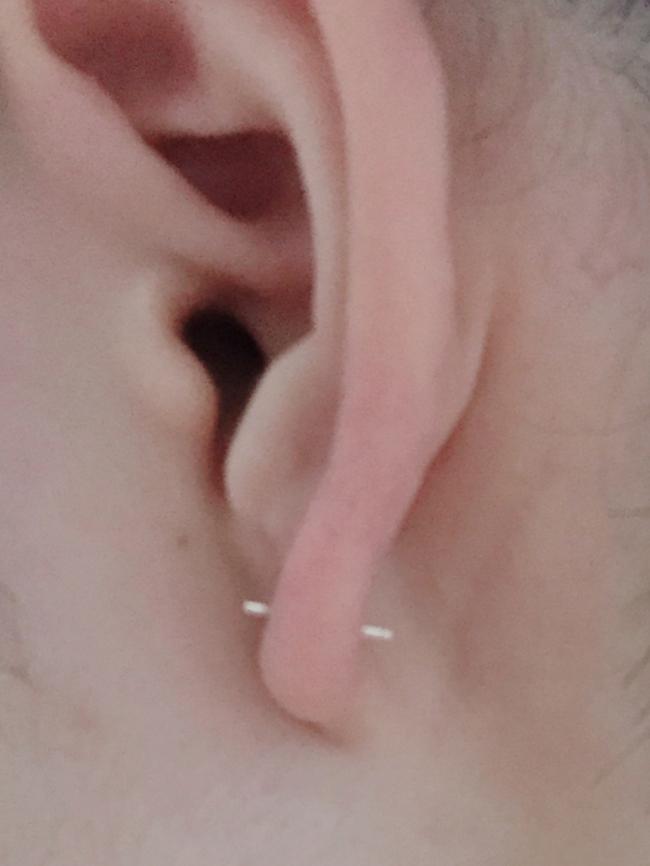 我这个耳洞算是打歪了吗？ 其实我感觉可能是我前段时间换耳钉捅歪的